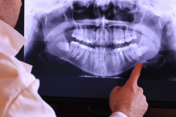 Best Walk-In Emergency Dentist in Decatur, AR