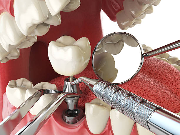Best Emergency Treatment for Toothache in Decatur, AR